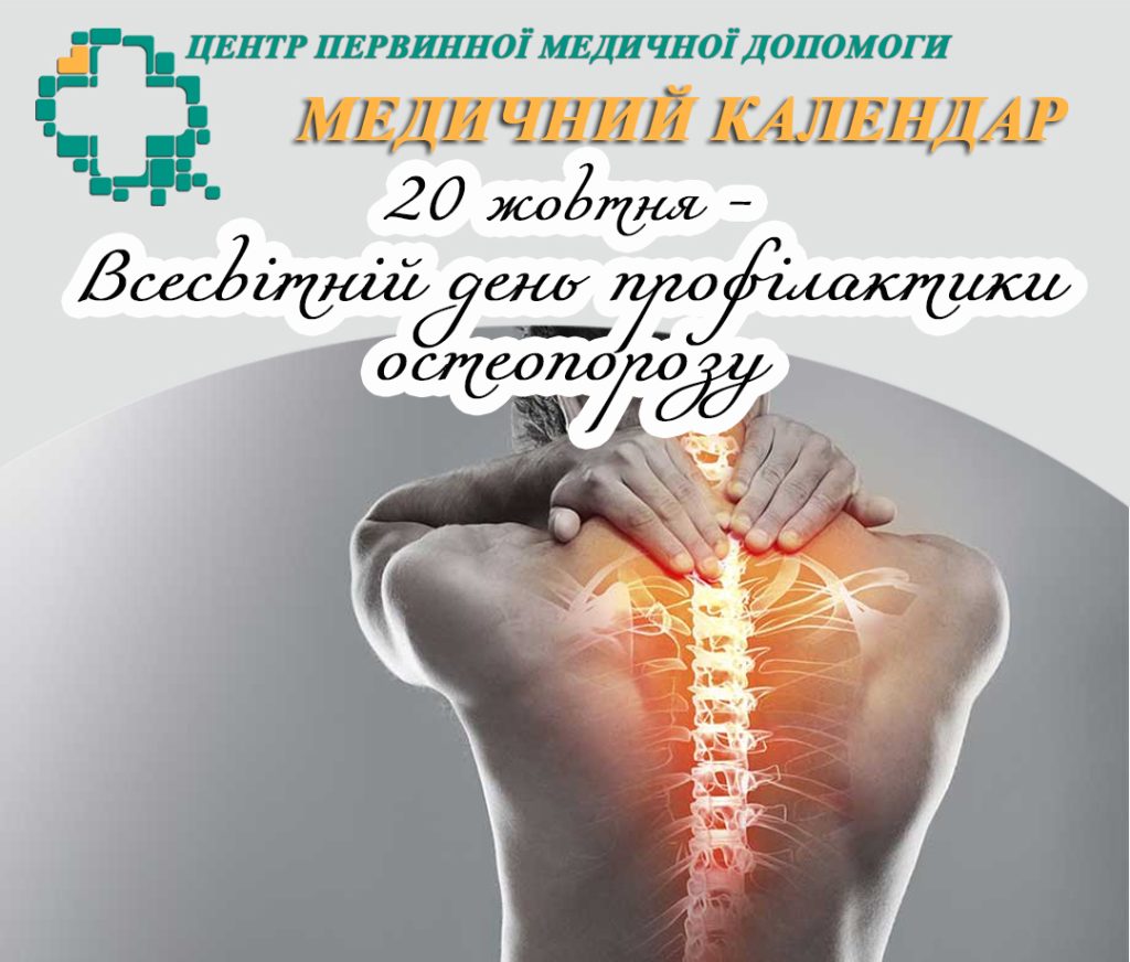 Остеопороз Остеопороз